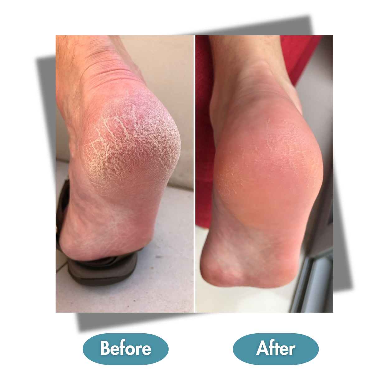 Balm Lab 超水潤足部修護霜 80克